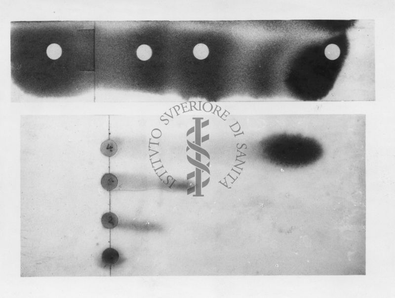 Perfezionamento della tecnica della micro-elettroforesi su carta