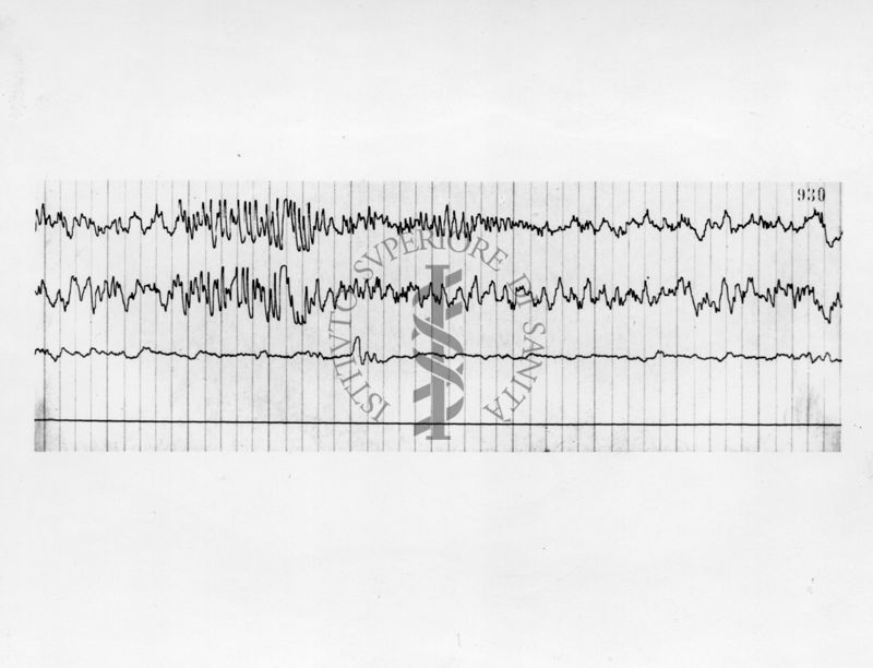 Elettroencefalografici di prove farmacologiche sulla idrazide dell'acido isonicotinico