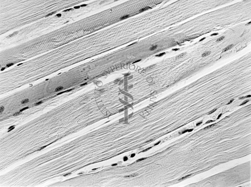 Effetto dell'ipertiroidismo sperimentale sulle alterazioni muscolari da avitaminosi nel ratto