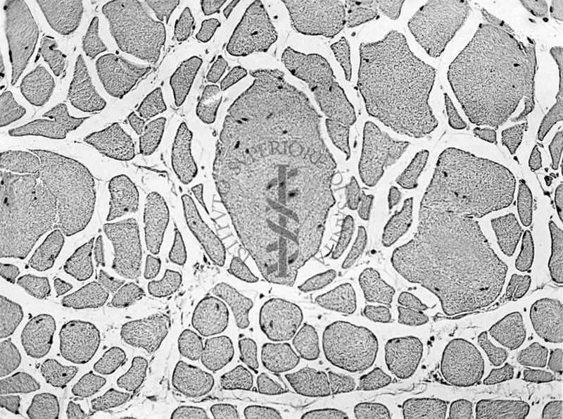 Effetto dell'ipertiroidismo sperimentale sulle alterazioni muscolari da avitaminosi nel ratto