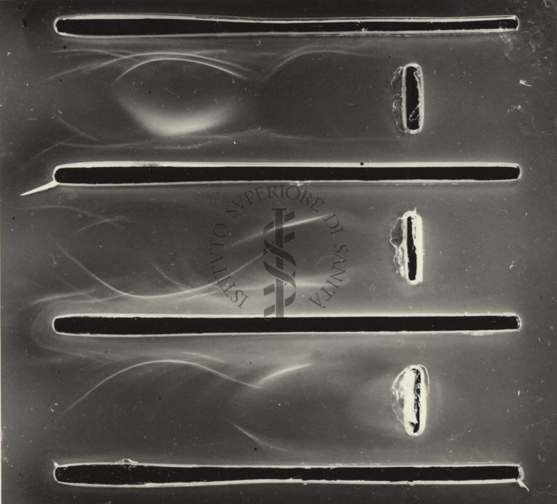 Immunoelettroforesi di tubercolare