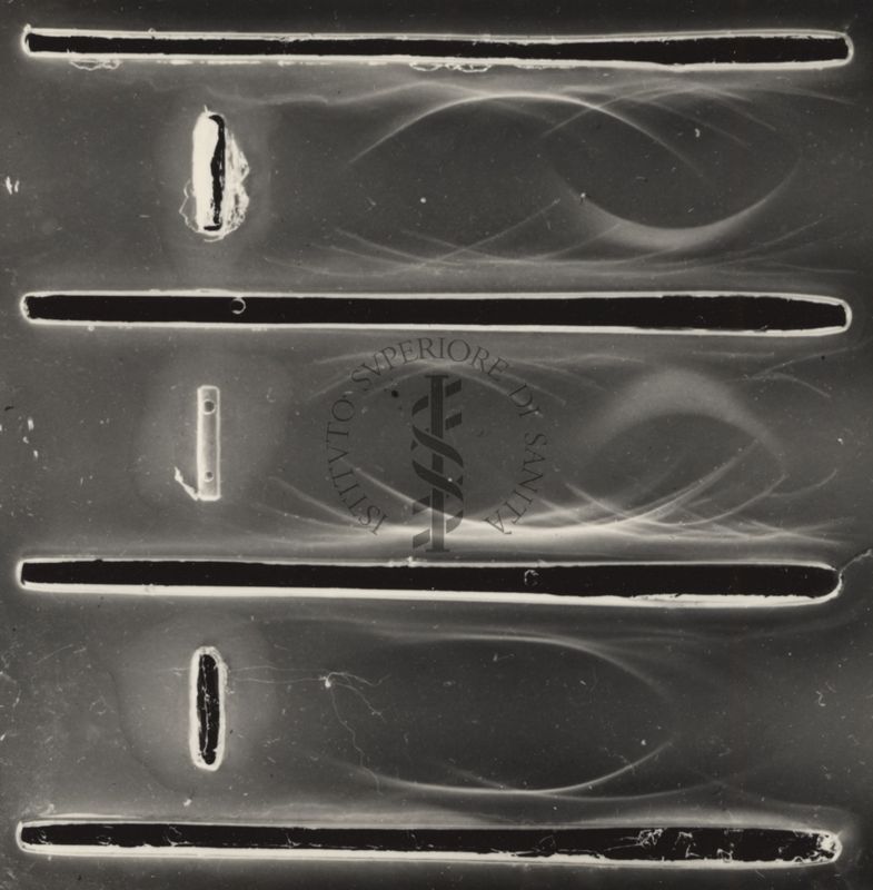 Immunoelettroforesi di tubercolare