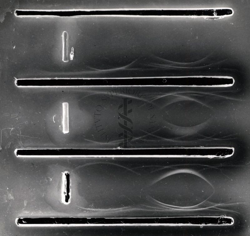 Immunoelettroforesi di tubercolare