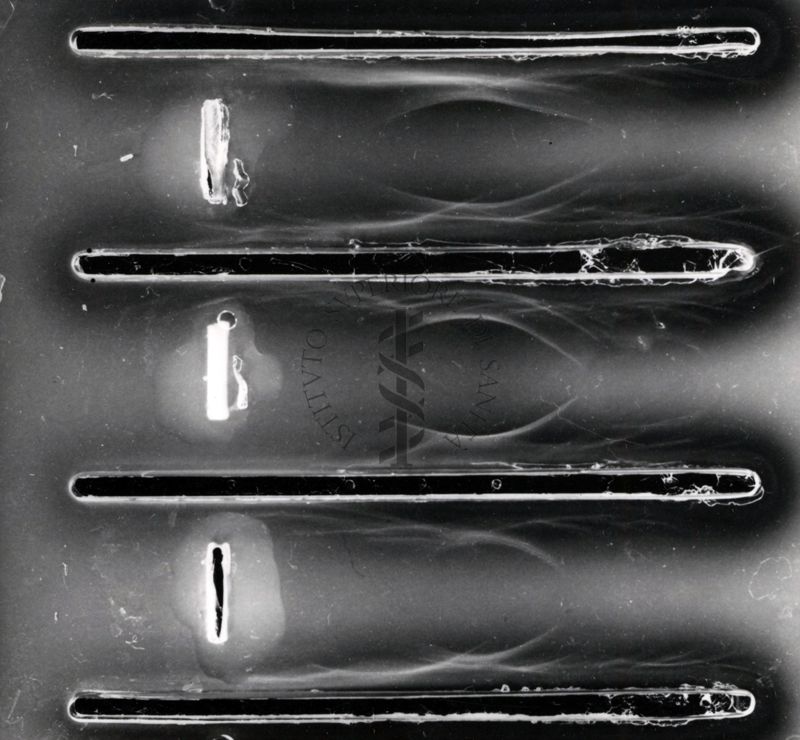 Immunoelettroforesi di tubercolare