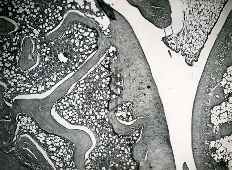 Azione degli ormoni somatotropo ed androgeno sulla cartilagine