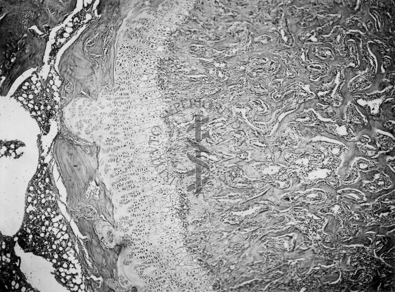 Azione degli ormoni somatotropo ed androgeno sulla cartilagine