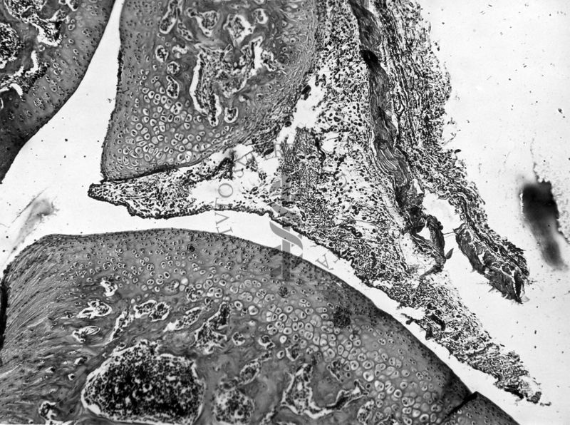 Azione degli ormoni somatotropo ed androgeno sulla cartilagine