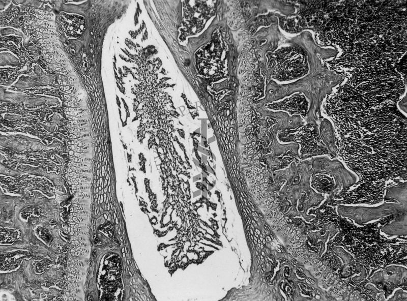 Azione degli ormoni somatotropo ed androgeno sulla cartilagine