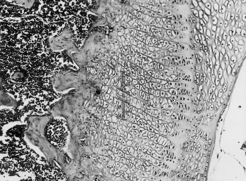 Azione degli ormoni somatotropo ed androgeno sulla cartilagine