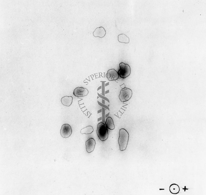 Montaggio di gel cromatografico su carta