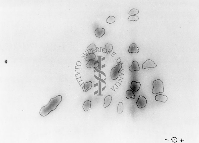 Montaggio di gel cromatografico su carta