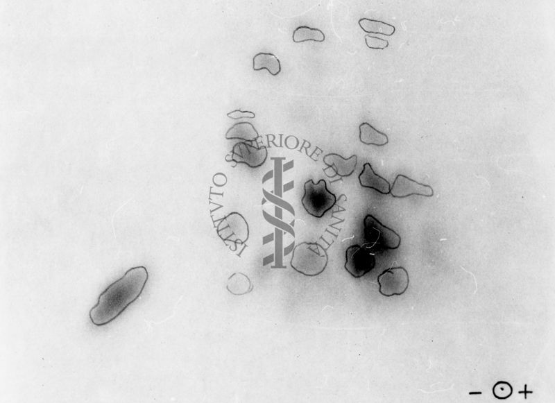 Montaggio di gel cromatografico su carta