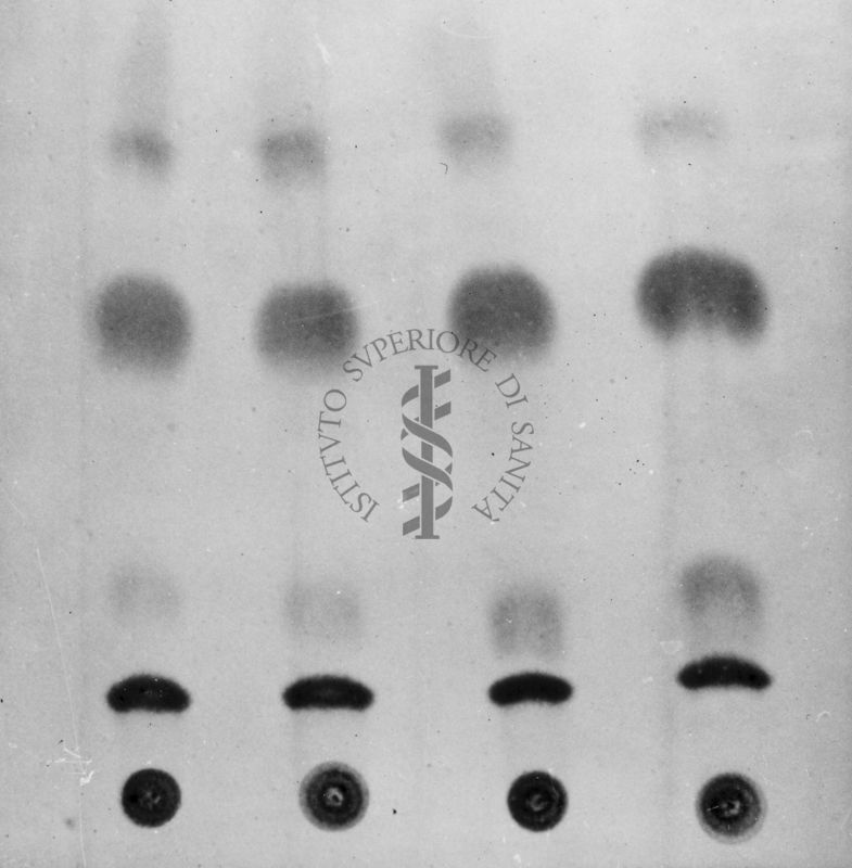 Montaggio di gel cromatografico su carta