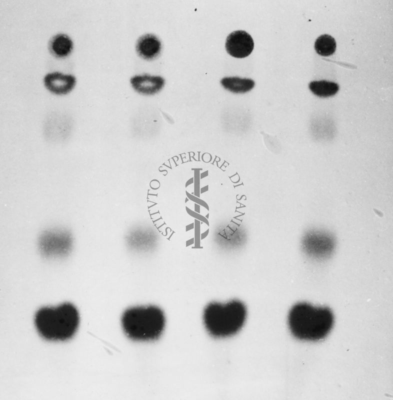 Montaggio di gel cromatografico su carta