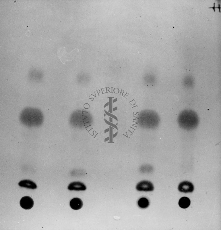 Montaggio di gel cromatografico su carta