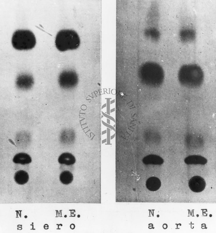 Montaggio di gel cromatografico su carta