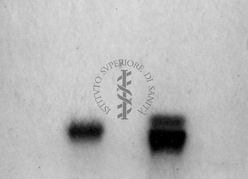 Montaggio di gel cromatografico su carta