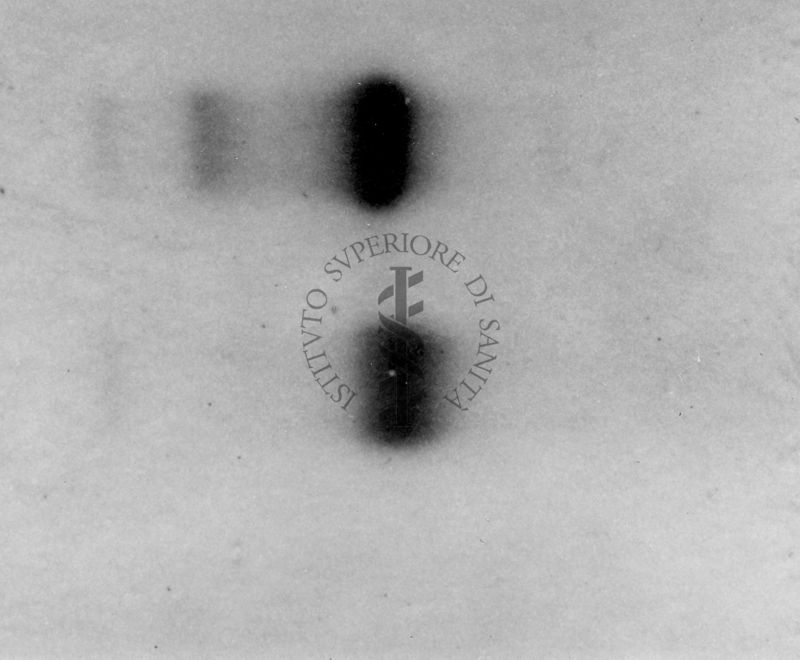 Montaggio di gel cromatografico su carta