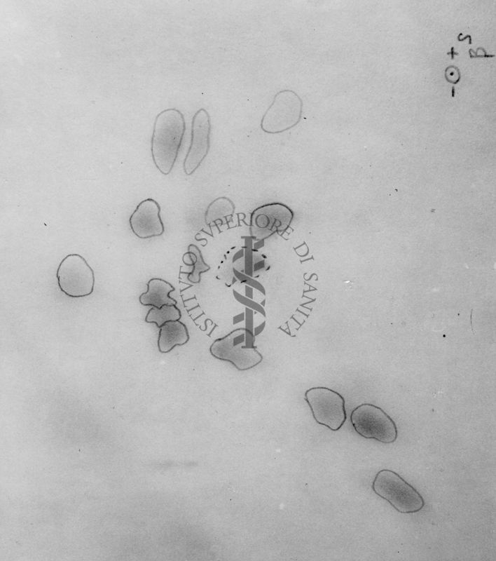 Montaggio di gel cromatografico su carta