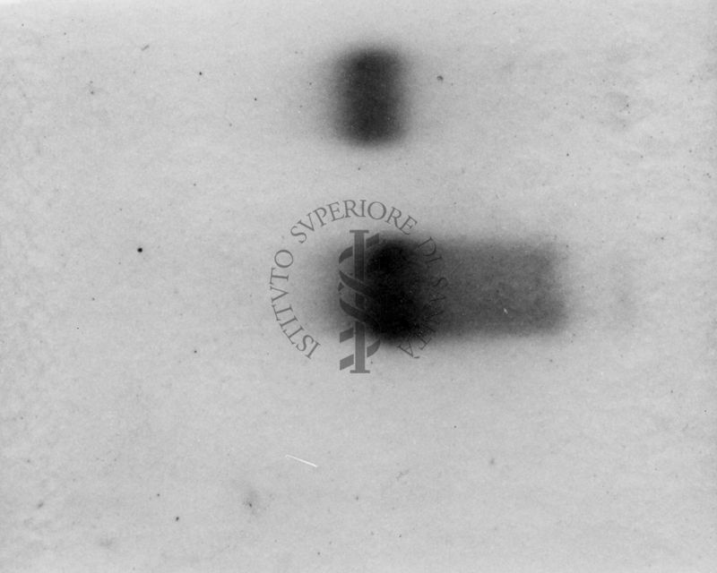 Montaggio di gel cromatografico su carta