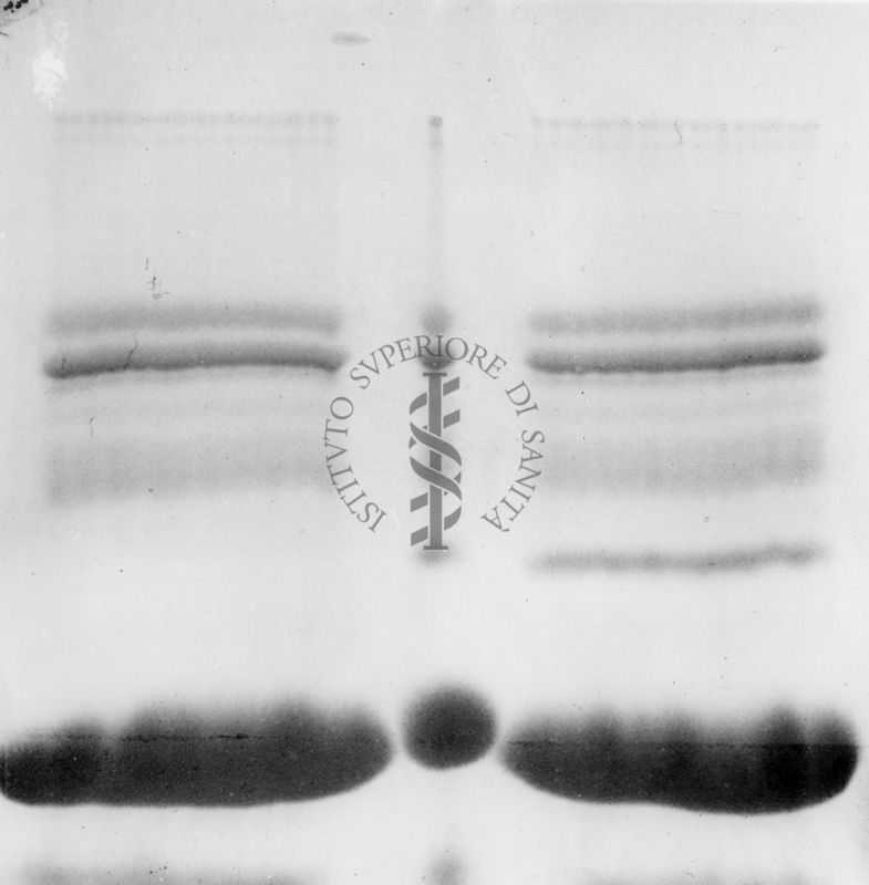 Montaggio di gel cromatografico su carta