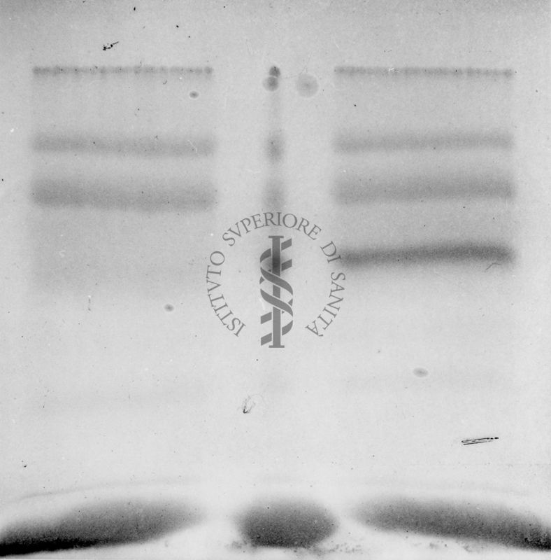 Montaggio di gel cromatografico su carta