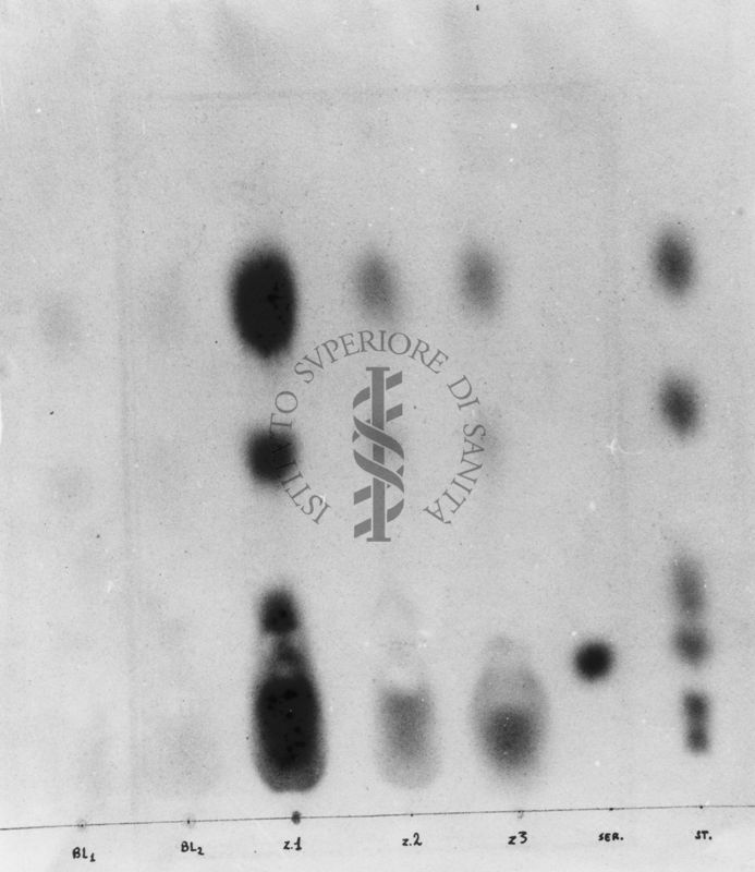 Montaggio di gel cromatografico su carta