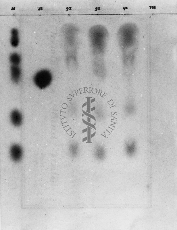 Montaggio di gel cromatografico su carta