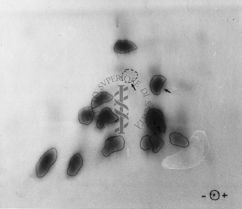 Montaggio di gel cromatografico su carta