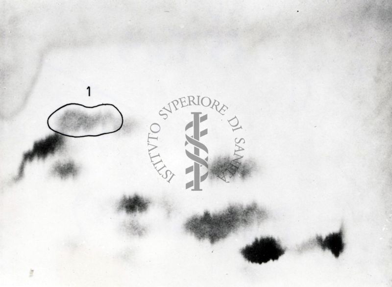 Metabolismo della cistina S.35 nel ratto