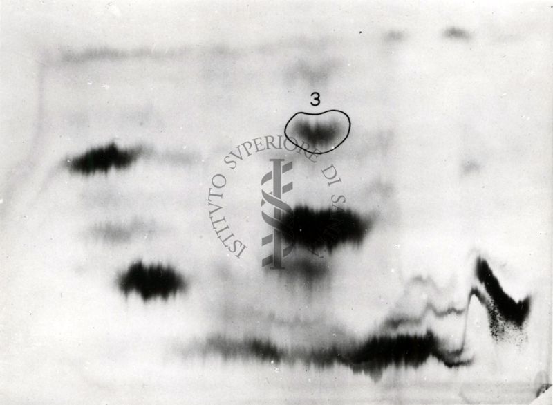 Metabolismo della cistina S.35 nel ratto