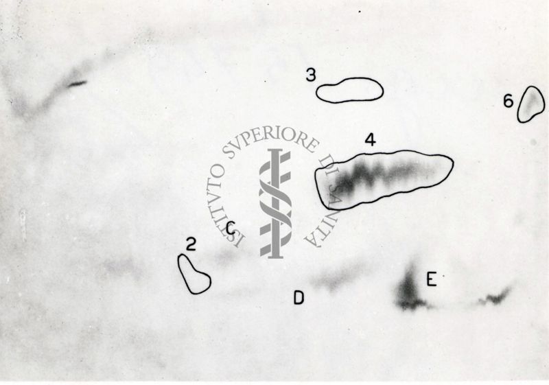 Metabolismo della cistina S.35 nel ratto