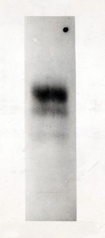 Cromatografia riguardante il destino dell'acido bromoacetico 2_C.14 sul topo