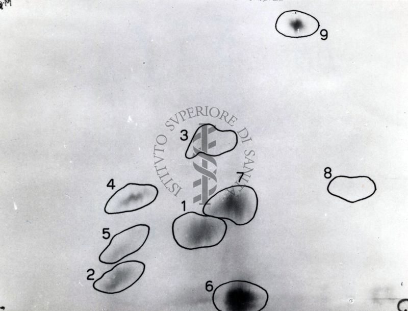 Metabolismo della Licistina S 35 nel ratto (cromatogrammi e auto-radiogrammi di estratto di rene e di urine)