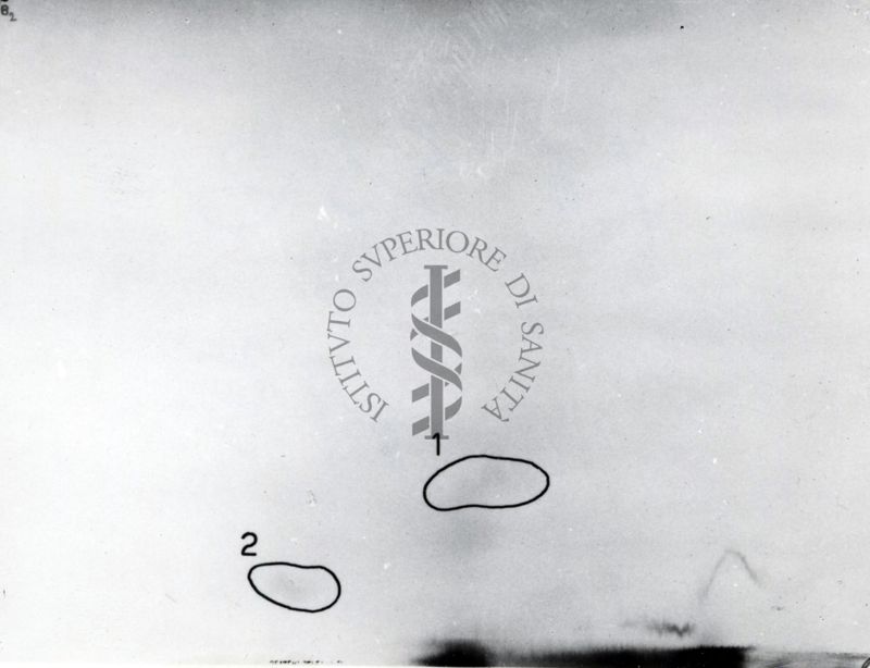 Metabolismo della Licistina S 35 nel ratto (cromatogrammi e auto-radiogrammi di estratto di rene e di urine)