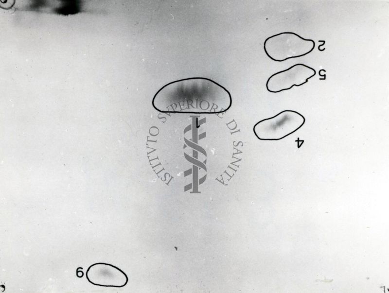 Metabolismo della Licistina S 35 nel ratto (cromatogrammi e auto-radiogrammi di estratto di rene e di urine)