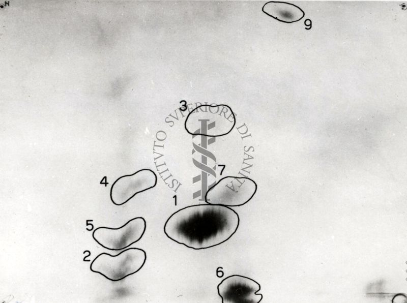 Metabolismo della Licistina S 35 nel ratto (cromatogrammi e auto-radiogrammi di estratto di rene e di urine)