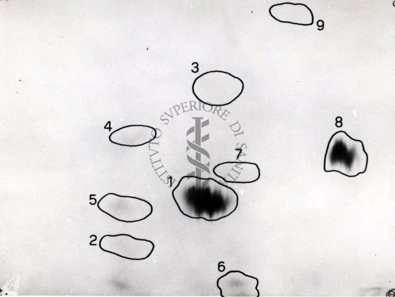 Metabolismo della Licistina S 35 nel ratto (cromatogrammi e auto-radiogrammi di estratto di rene e di urine)