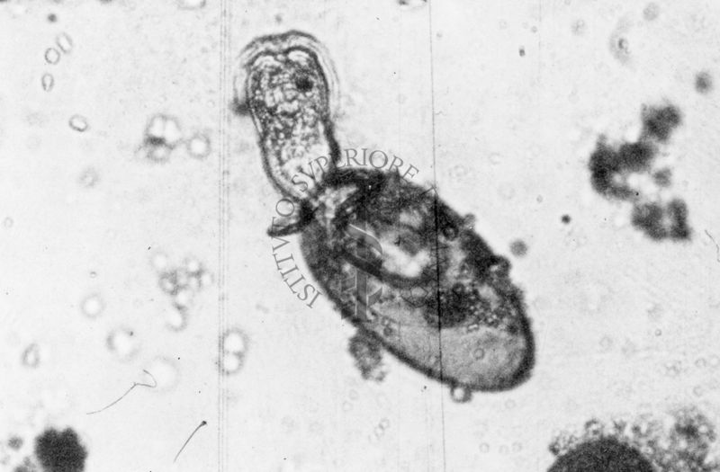 Probabilmente, immagine di Gregarina sp. (Apicomplexa)