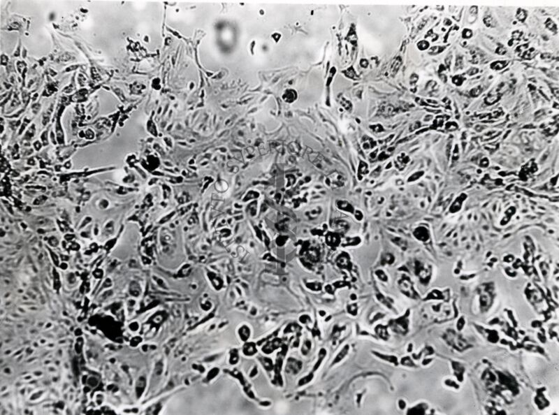 Colture miste di rene di scimmia e carcinoma della mammella di topo C 3 H