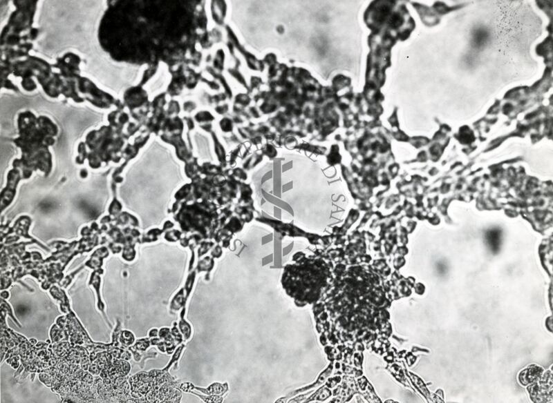 Colture miste di rene di scimmia e carcinoma della mammella di topo C 3 H