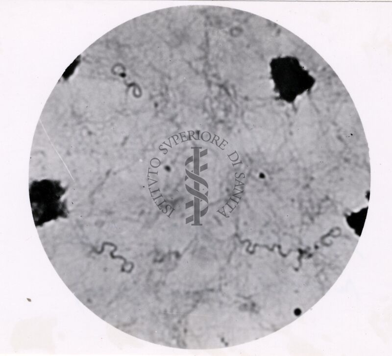 Spirochete della febbre ricorrente (gonia spessa)