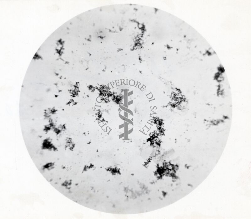 Microaglutinazioni di Virus