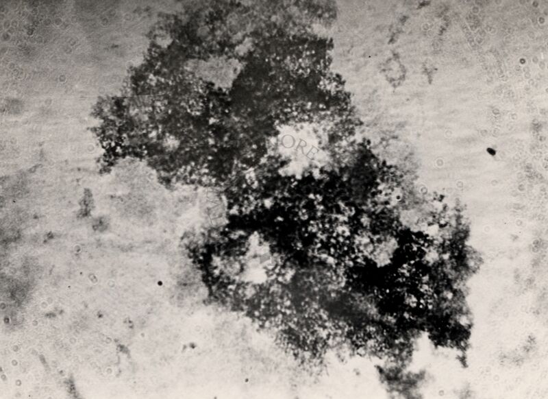 Microaglutinazioni di Virus