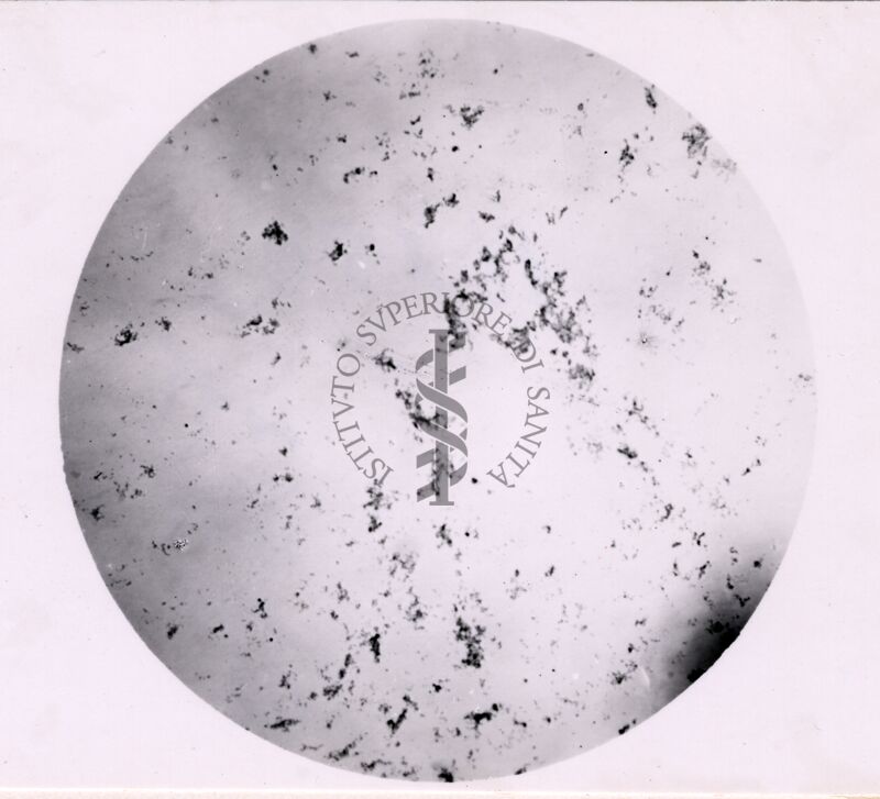 Microaglutinazioni di Virus