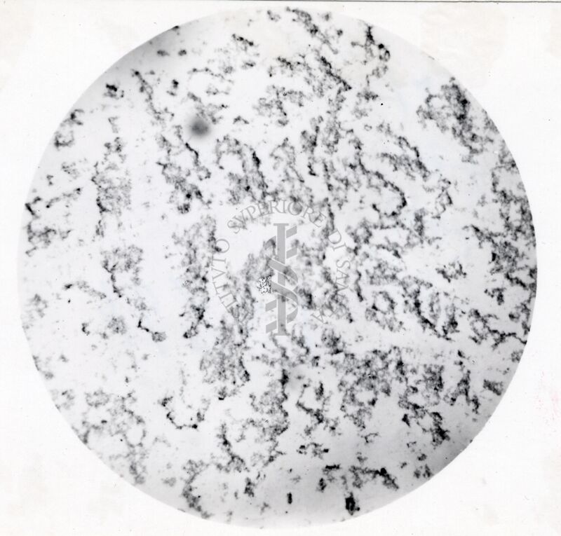 Microaglutinazioni di Virus