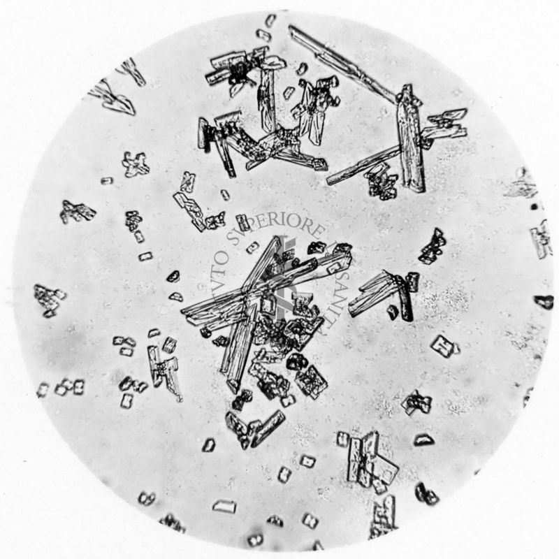 Micro-ricerca dell'arsenico come arseniato ammonico-calcico