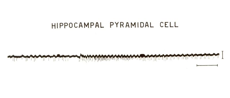 Cellule piramidali dell'ippocampo, tracciato nero su sfondo bianco