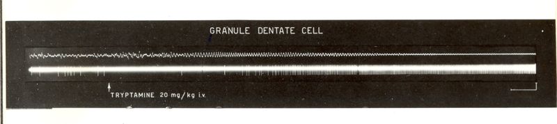 Granulate dental cell: due tracciati bianchi su sfondo nero. Sotto il secondo tracciato è scritto: Tryptamine 20 mg/kg i.v.