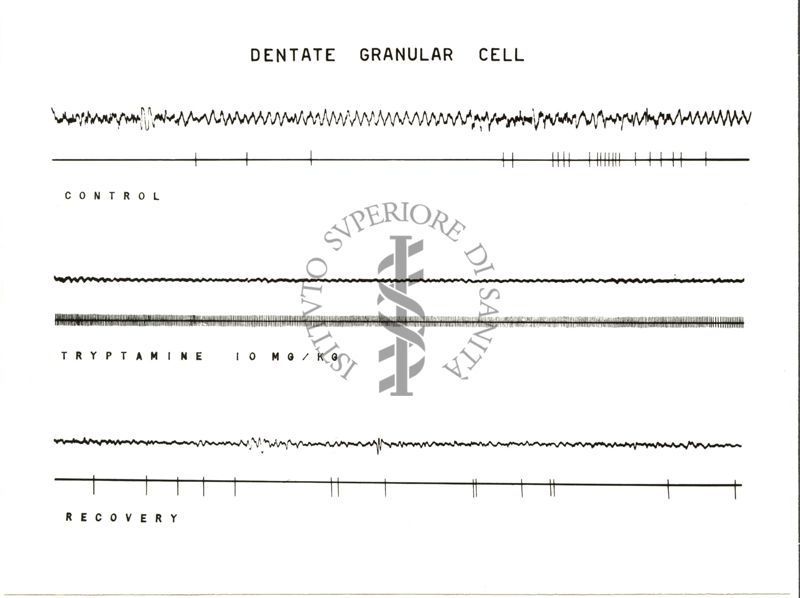 Dentate granular cell: 6 tracciati neri su sfondo bianco. Sotto il secondo tracciato è scritto: tryptamine 20 mg/kg